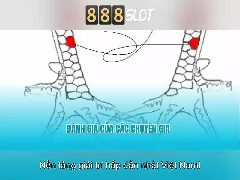 Ưu Điểm Của 888 Slot